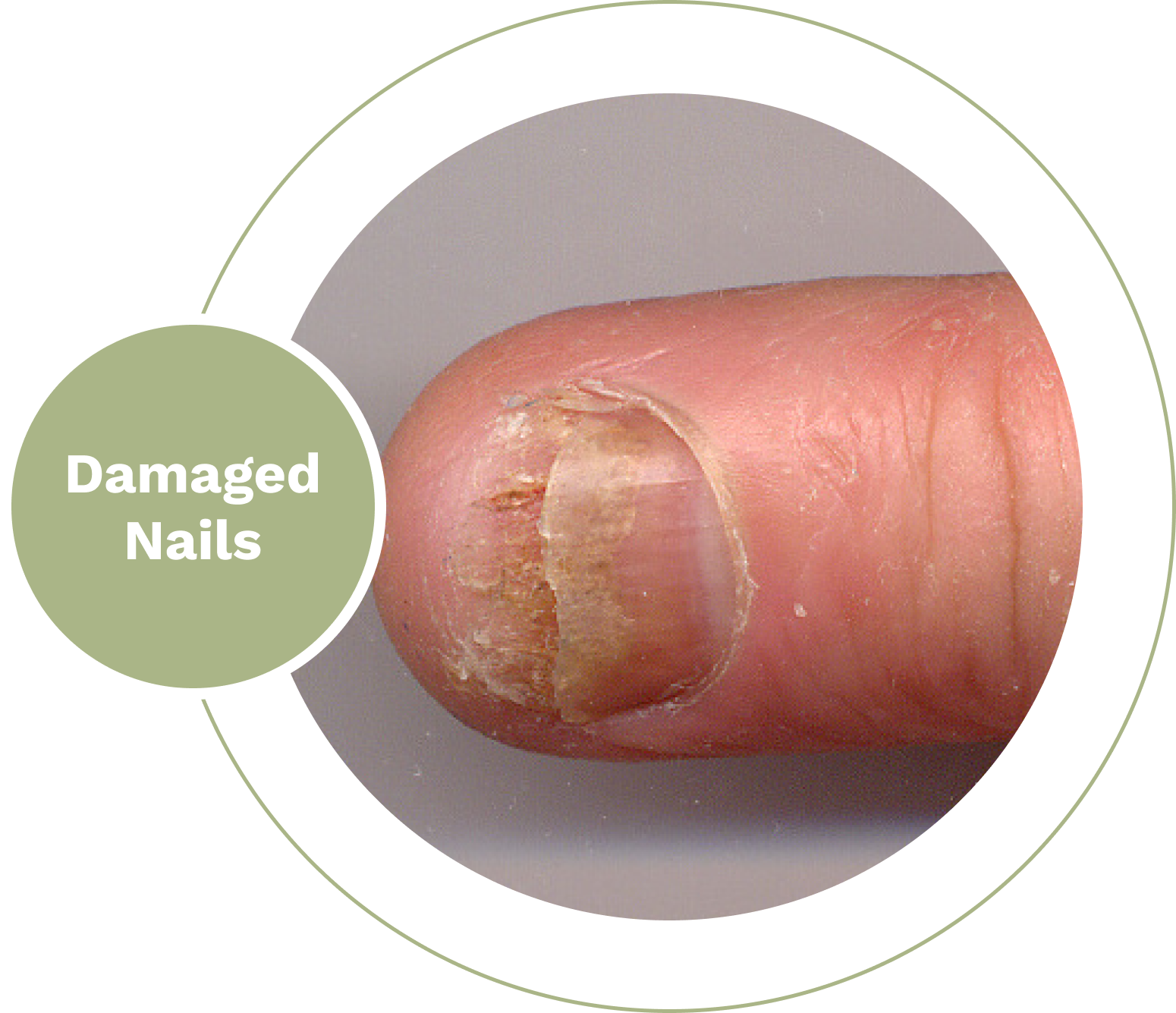 Damaged Nails